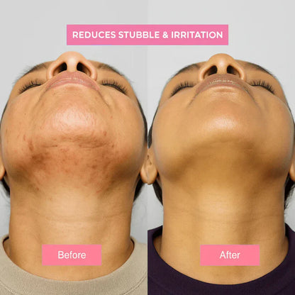 Cyperus Rotundus Oil